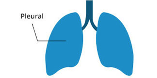 symptome cancer poumon droit