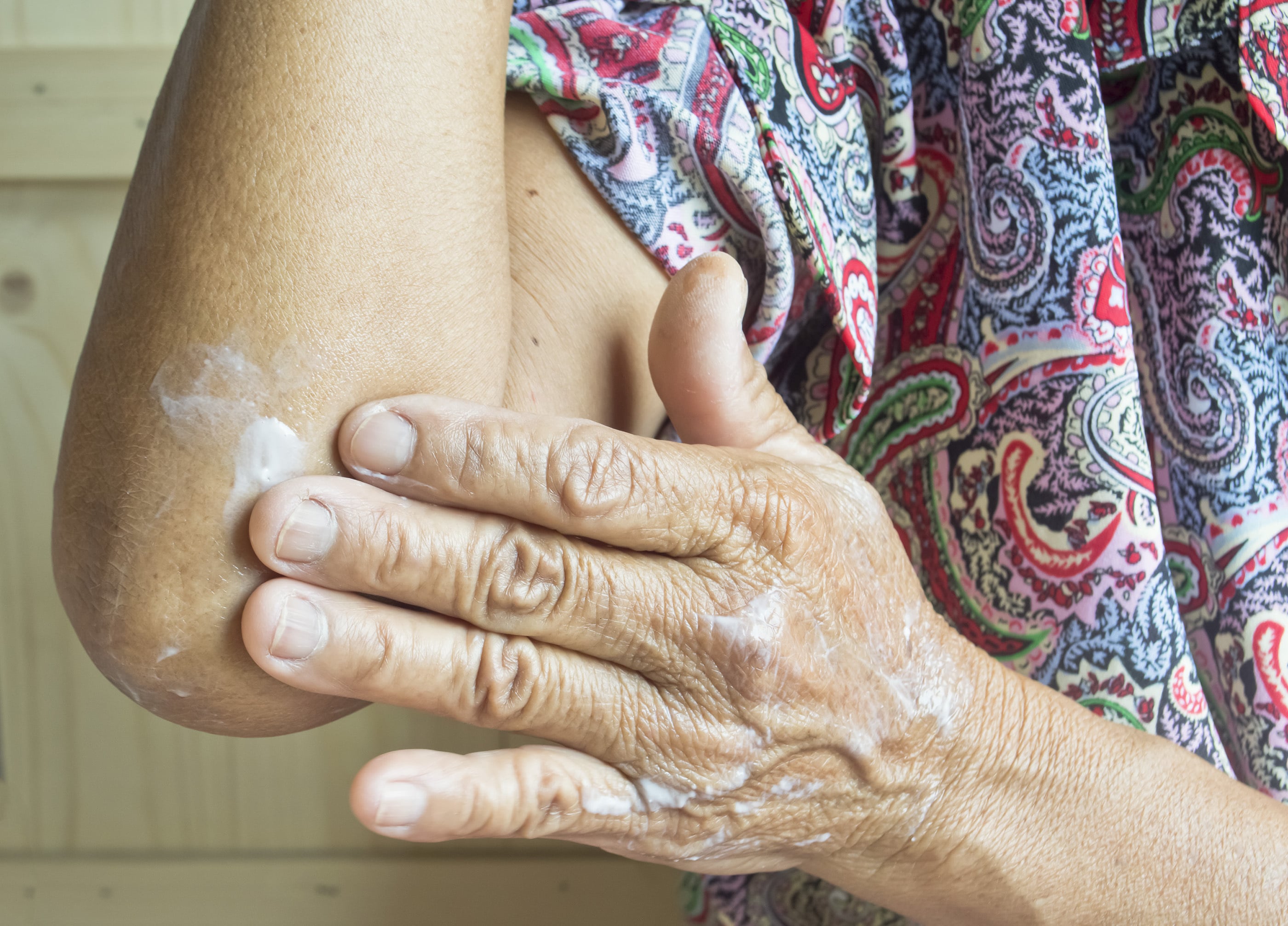 Mesothelioma lotion