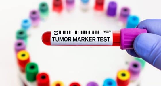 biomarker