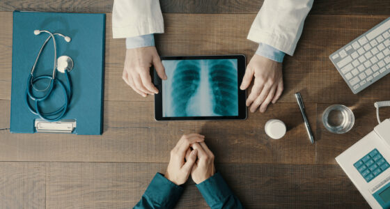 lung cancer