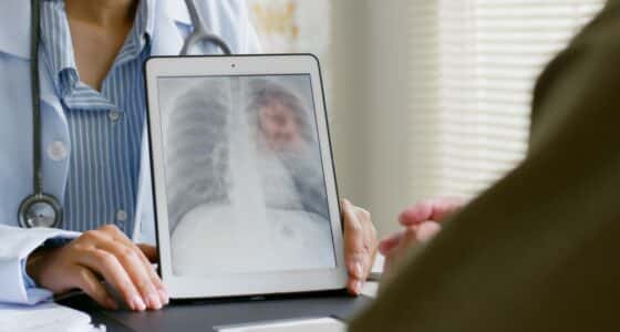 lung xray