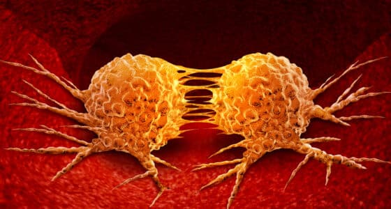 tumor growth