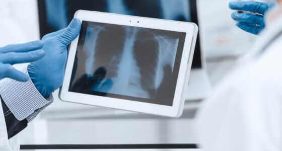 lung analysis
