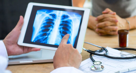 lung x-ray