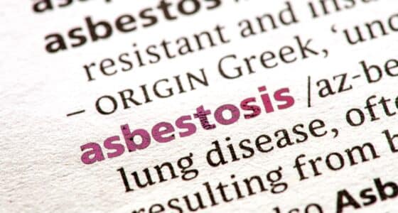 asbestosis