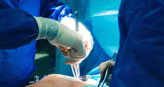 minimally invasive surgery